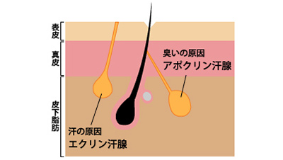 ボトックス（ワキ・手のひら・足の裏・額生え際）