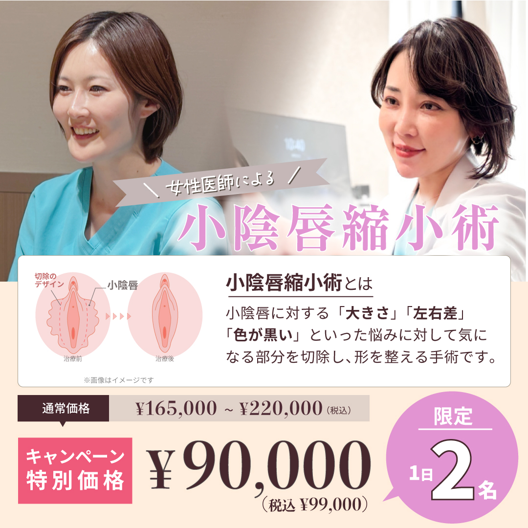 小陰唇縮小術キャンペーンバナー