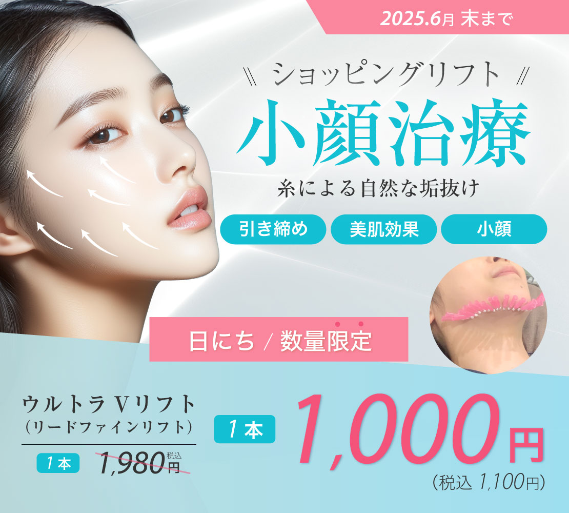 糸リフト その2キャンペーンバナー