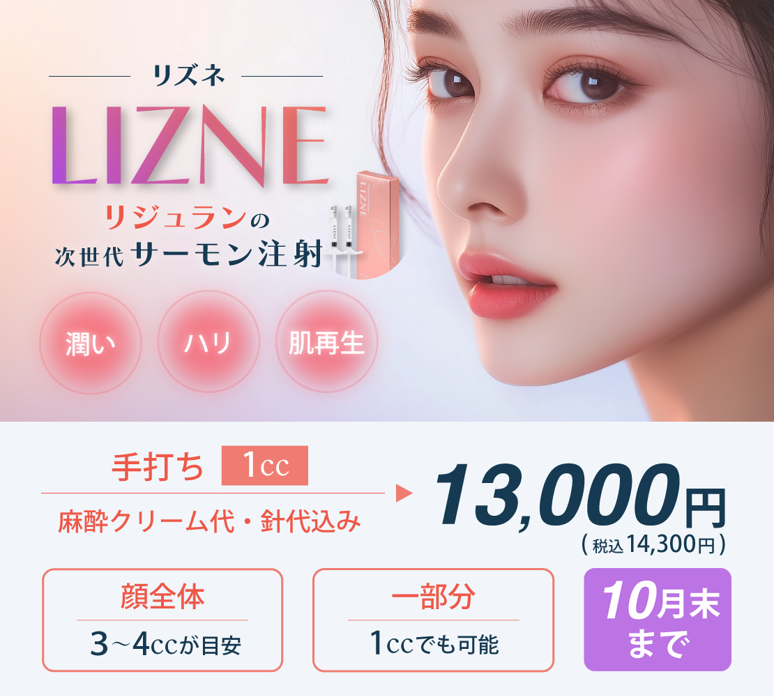 リズネキャンペーンバナー