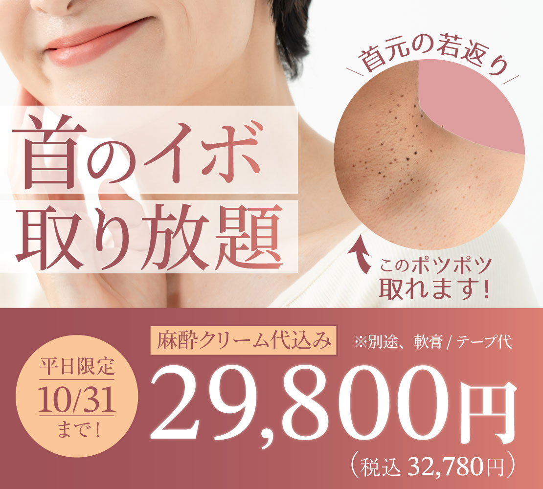 首のイボ 取り放題キャンペーンバナー