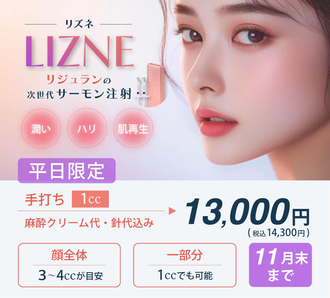 リズネキャンペーンバナー