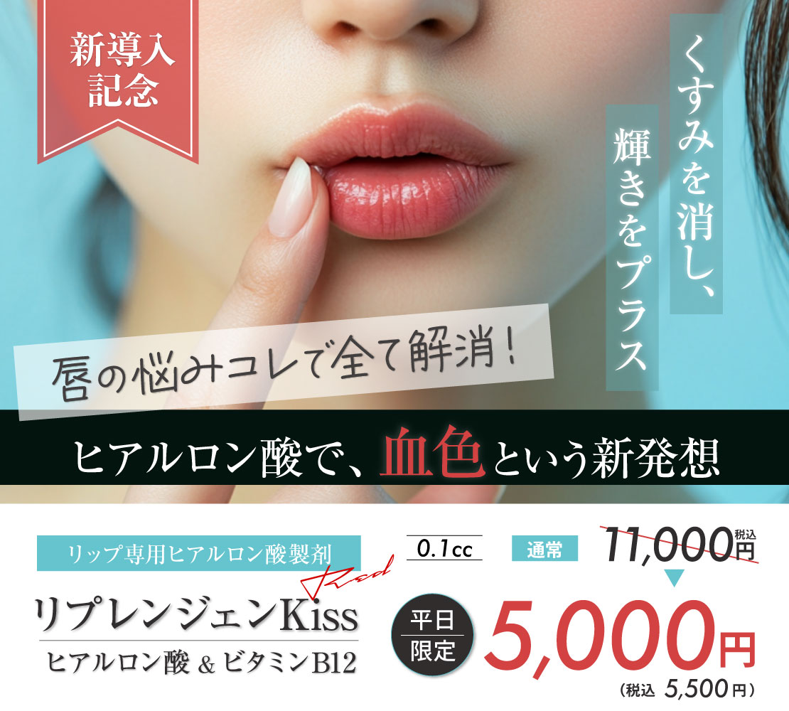 リプレンジェンKissバナー