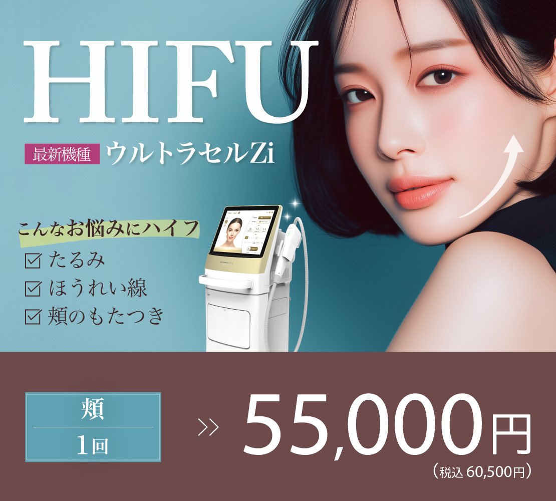 ウルトラセルZi　バナー