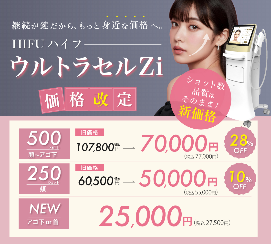 ウルトラセルZi新価格バナー