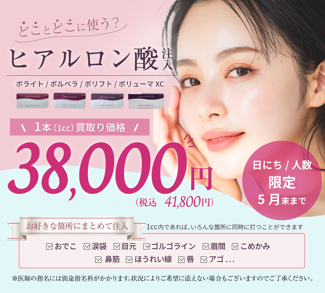 ヒアルロン酸注入キャンペーンバナー