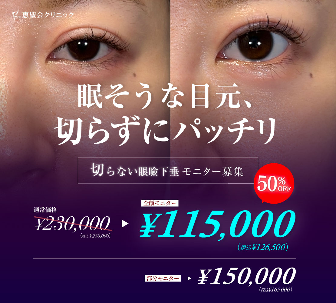 「切らない眼瞼下垂」モニター募集バナー