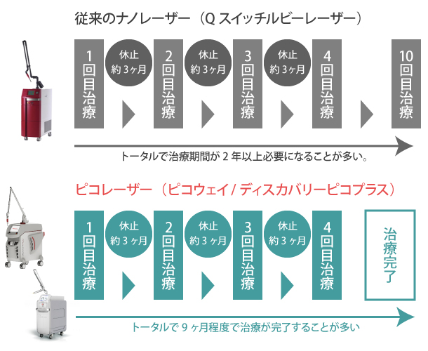 PICO（ピコ）タトゥー