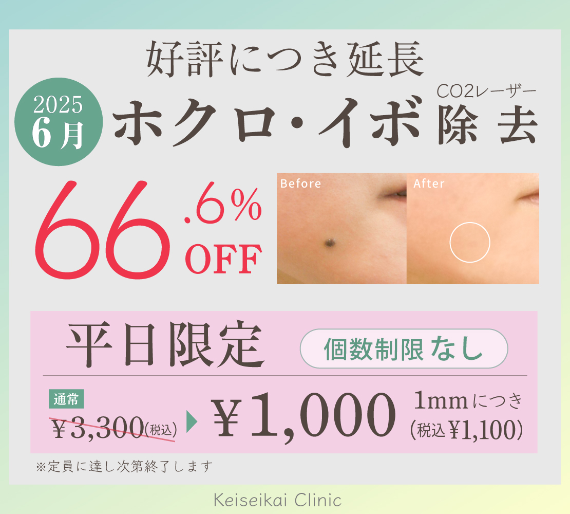 ホクロ・イボ除去キャンペーンバナー