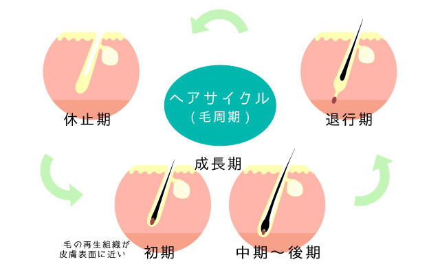 医療レーザー 脱毛 エステ 永久脱毛 レーザー脱毛 ヘアサイクル
