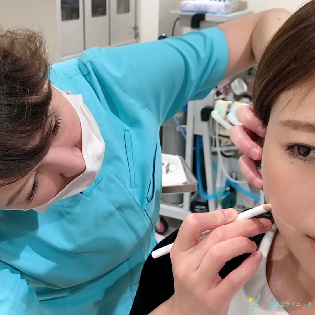 気づくと小顔