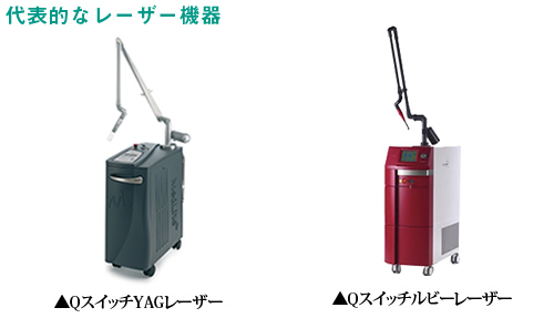 Qスイッチ YAGレーザー ルビーレーザー