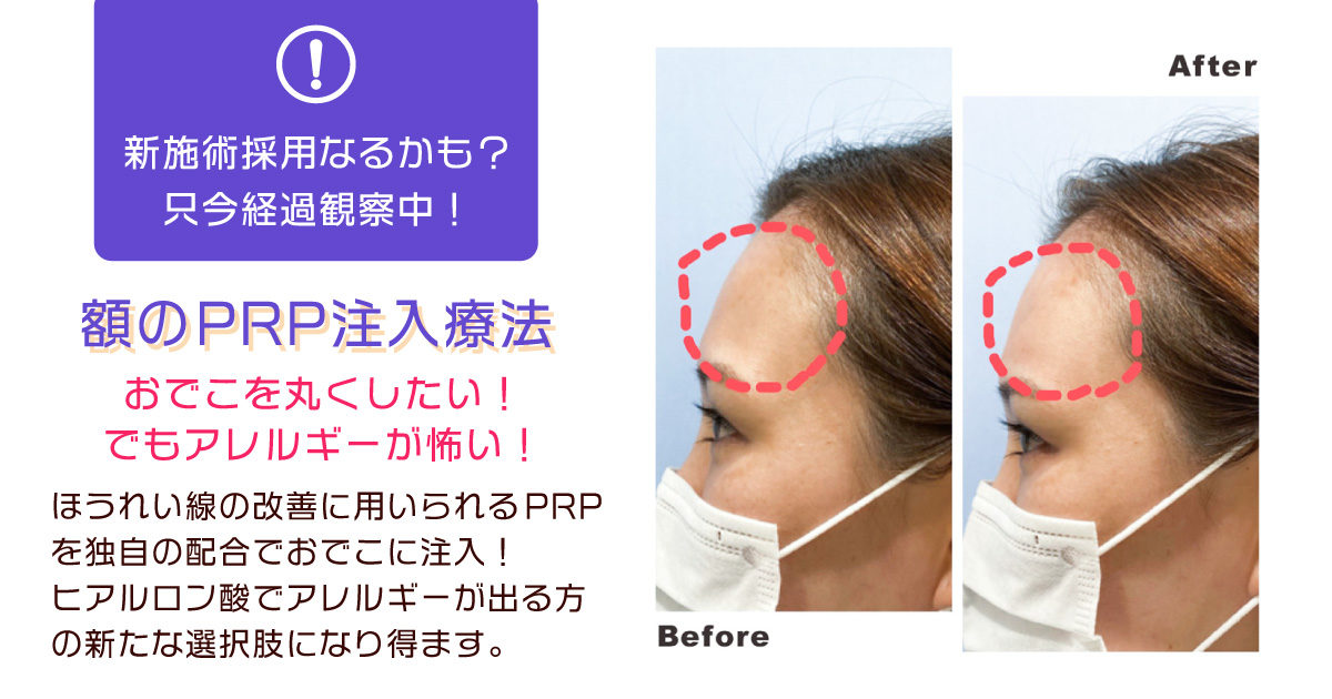 理想のまーるいおでこ 恵聖会クリニック 大阪の美容外科 美容皮膚科 理想のまーるいおでこ 恵聖会クリニック 大阪の美容外科 美容皮膚科