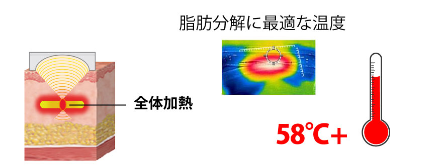 リニア（線状）照射のイメージ図