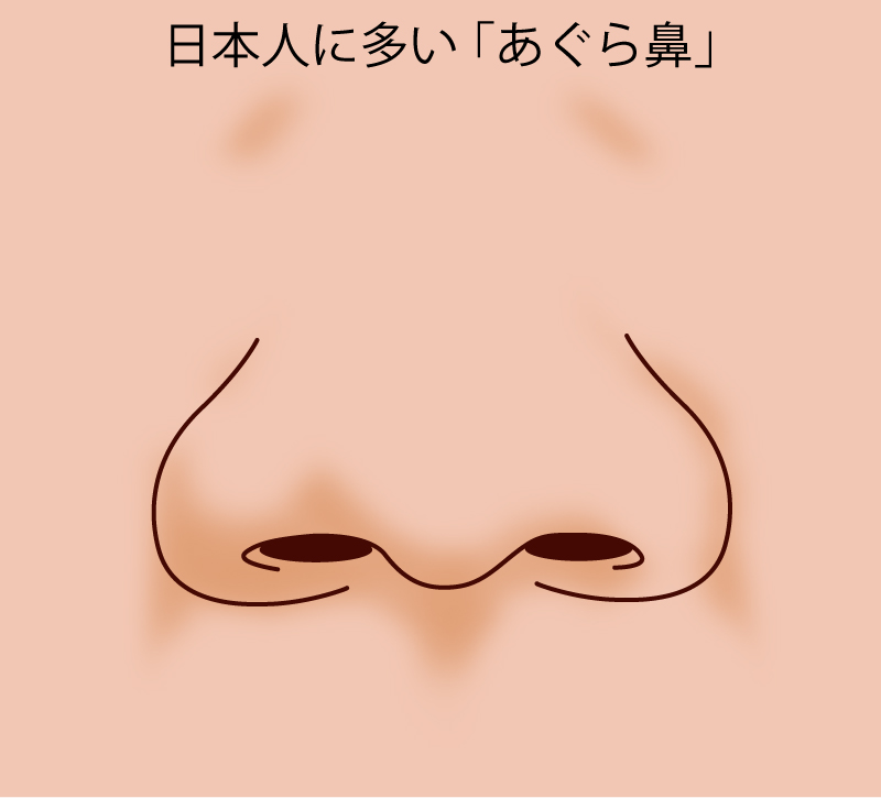 あぐら鼻イメージ