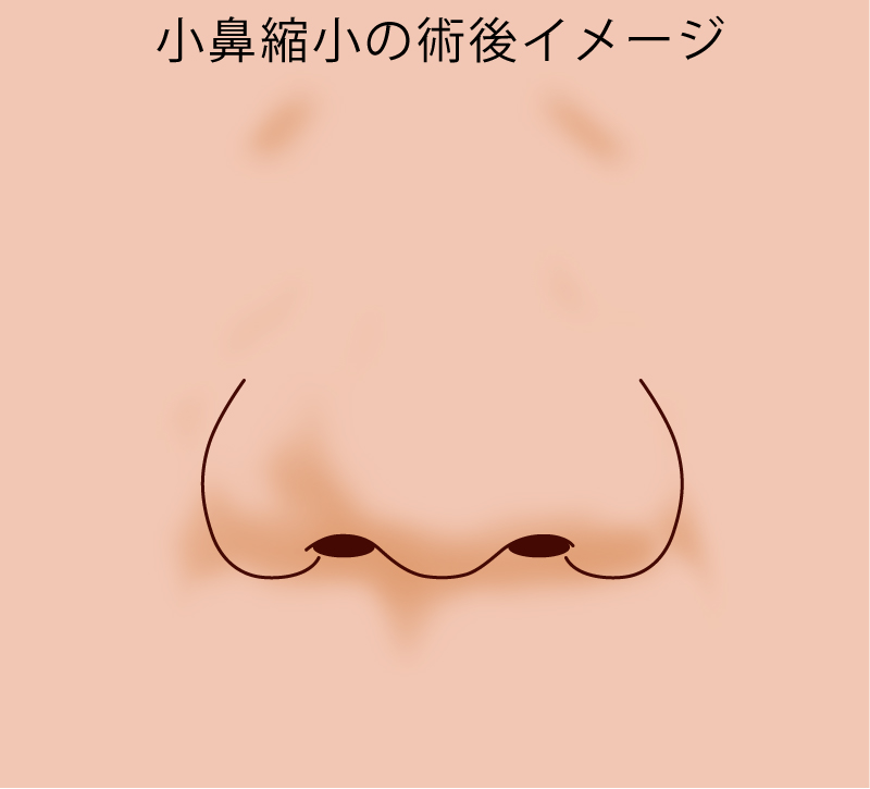 術後イメージ