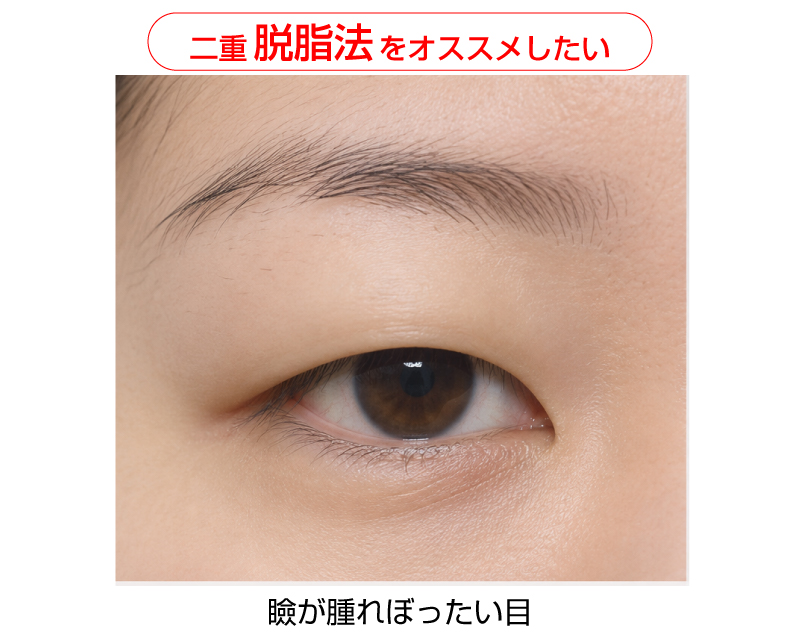 瞼が腫れぼったい目