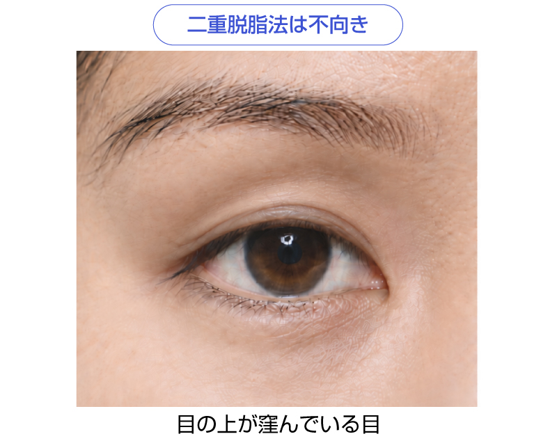 目の上が窪んでいる目