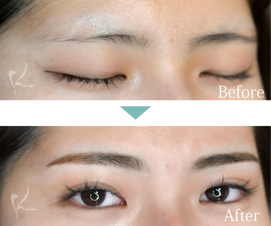 アートメイク　眉　Air Brow症例写真