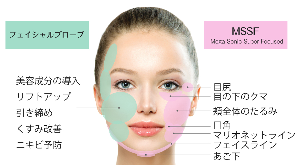 ベレーザプロのMSSFハンドピースとフェイシャルハンドピースにより期待できる効果と部位