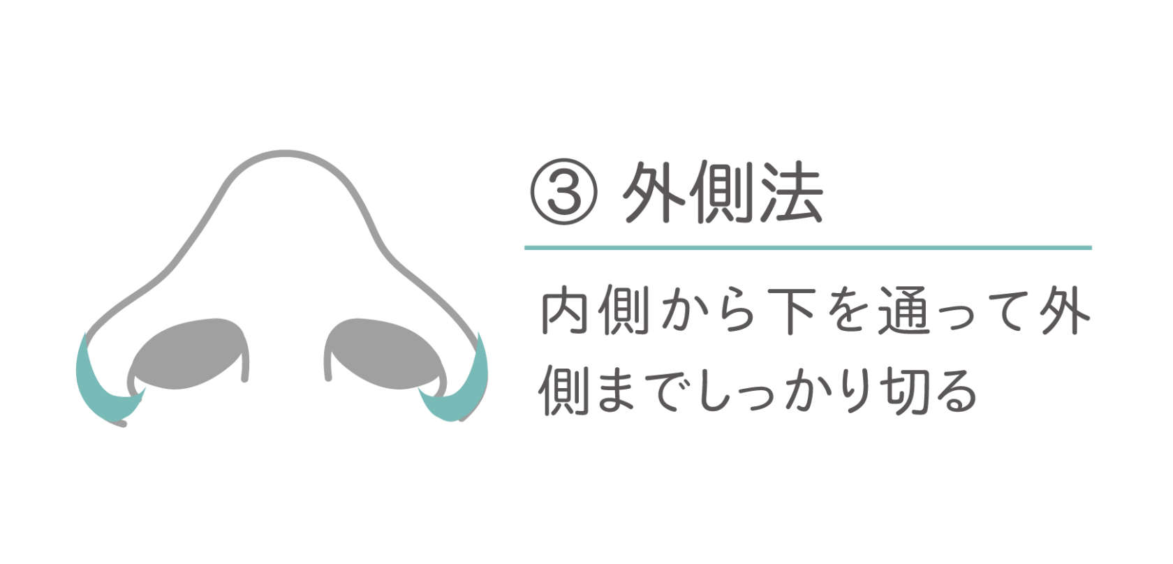 小鼻(鼻翼)縮小術 外側法