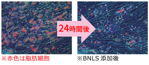 bnls 小顔注射 脂肪溶解 部分痩せ ダイエット 痩身 メディカルダイエット