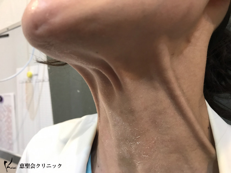 同じ人間の首とは、、、