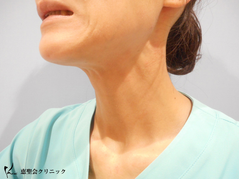 同じ人間の首とは、、、