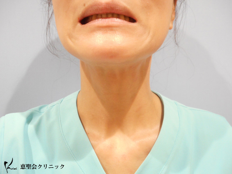 同じ人間の首とは、、、