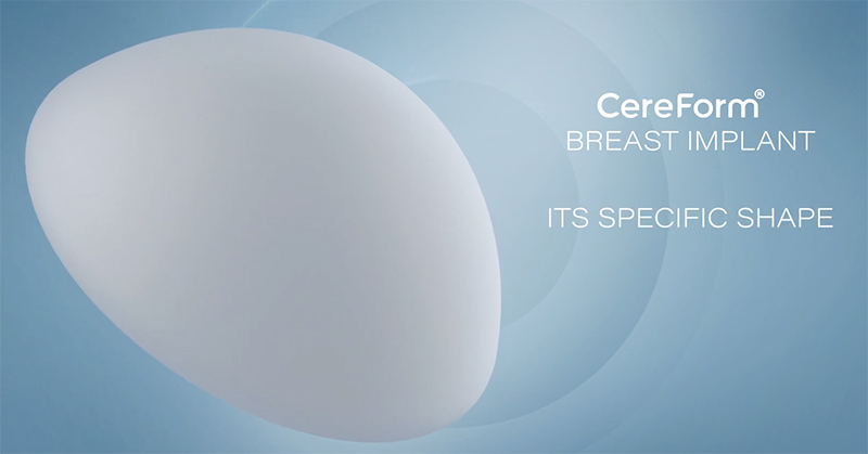 セレフォームイメージ画像1