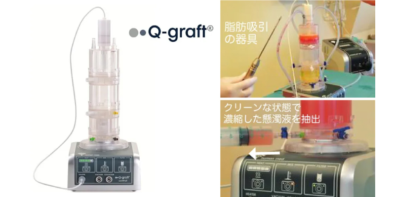 Q-graftシステム