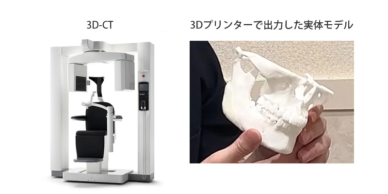 3Dプリンター活用のイメージ