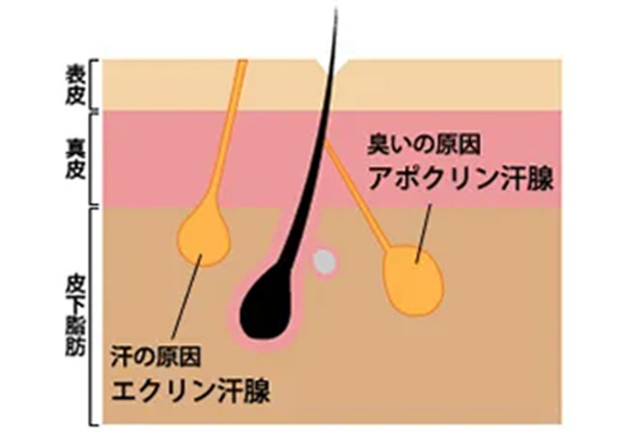 ワキガの原因となる脇の汗腺について説明する医師