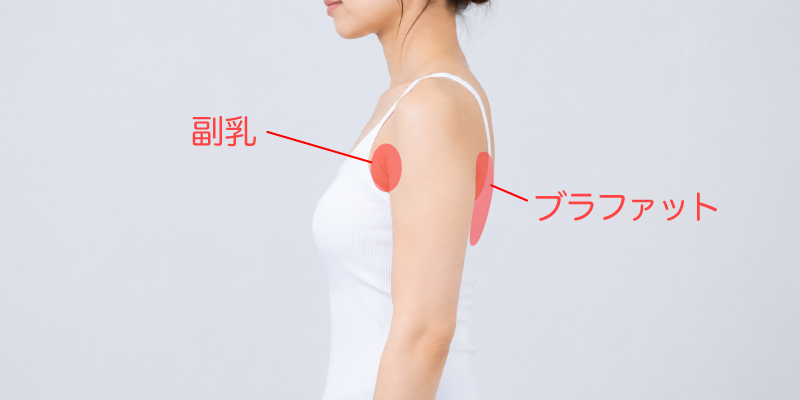 副乳・ブラファットイメージ
