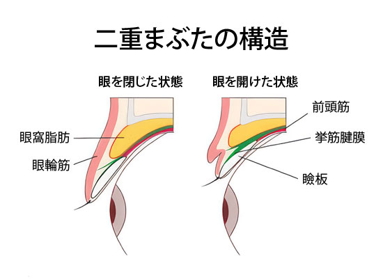 二重の形成方法について説明するイメージ