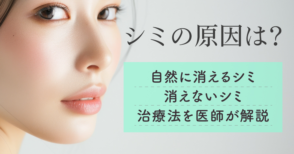 シミの原因と自然に消えるシミ・消えないシミの治療法を解説