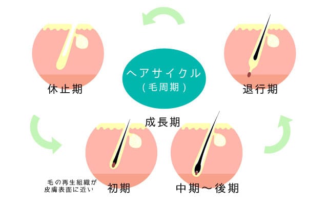 女性型脱毛症や休止期脱毛症など女性の抜け毛の原因を示すイメージ