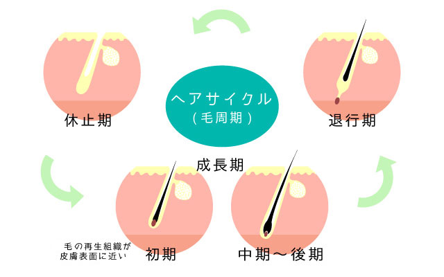 女性の薄毛とヘアサイクルの変化を解説するイメージ