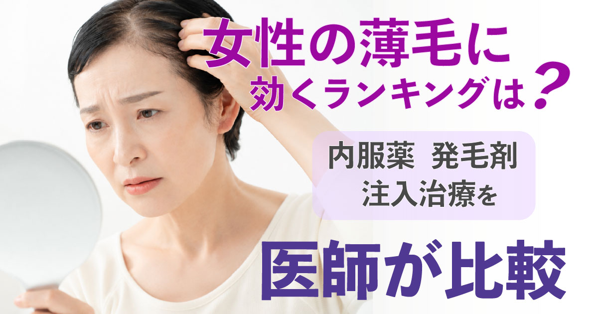 女性の薄毛に効く発毛剤・内服薬・注入治療を比較するイメージ
