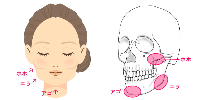 頬骨・エラ・オトガイを整える輪郭3点のイメージ