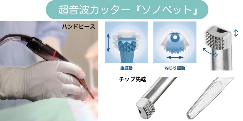 超音波骨切削器（超音波カッター）ソノペットのイメージ