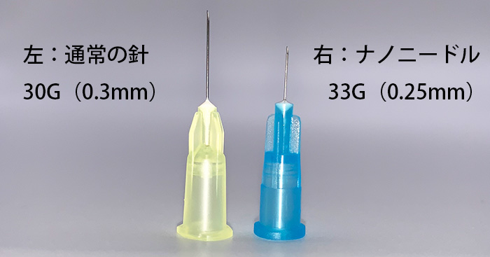 恵聖会クリニックのMT埋没法・ブリッジ法で使用する超極細針（ナノニードル）のイメージ