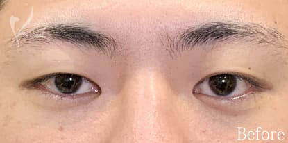 Before写真