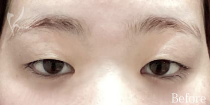 Before写真