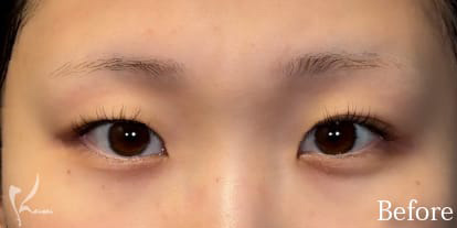 Before写真