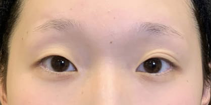 Before写真