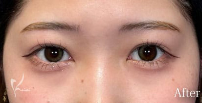 Before写真