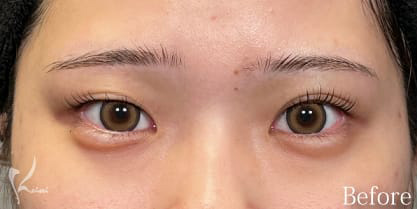 Before写真