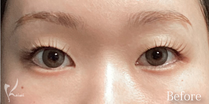 Before写真