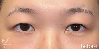 Before写真